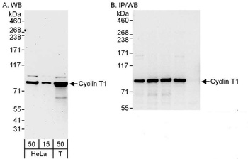 Rabbit Cyclin T1 Antibody