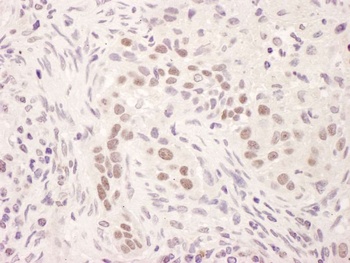Rabbit GR Antibody