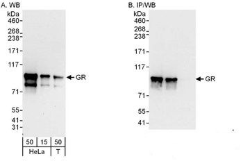 Rabbit GR Antibody