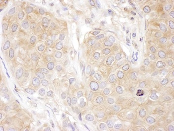 Rabbit DCTN2 Antibody