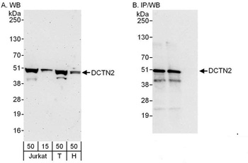Rabbit DCTN2 Antibody