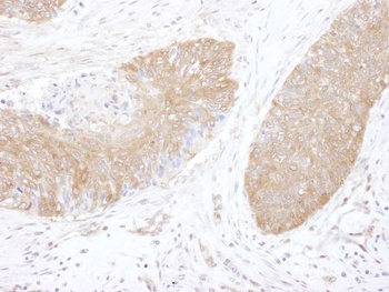 Rabbit CCT5 Antibody