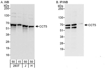 Rabbit CCT5 Antibody