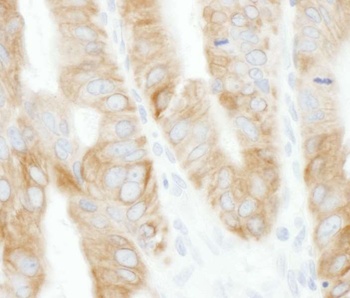 Rabbit TRAF2 Antibody