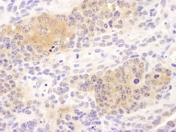 Rabbit CCT8 Antibody