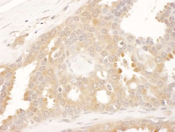 Rabbit CCT8 Antibody