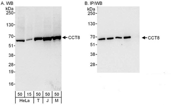 Rabbit CCT8 Antibody