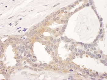 Rabbit CCT8 Antibody