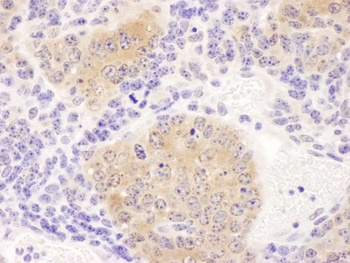 Rabbit CCT8 Antibody