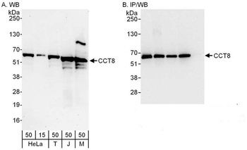 Rabbit CCT8 Antibody