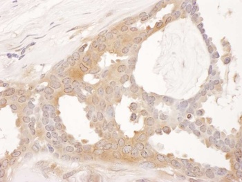 Rabbit CCT8 Antibody