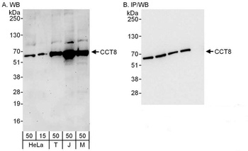 Rabbit CCT8 Antibody