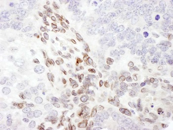 Rabbit anti-Lamin-A Antibody
