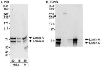 Rabbit anti-Lamin-A/C Antibody