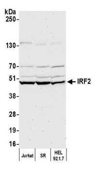 Rabbit IRF2 Antibody