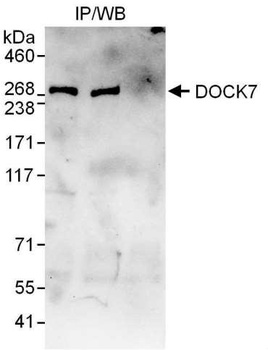 Rabbit DOCK7 Antibody