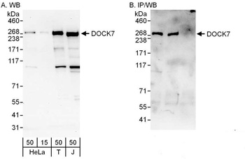 Rabbit DOCK7 Antibody