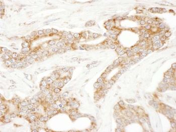 Rabbit CLIP170 Antibody