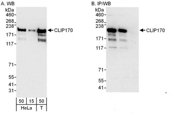 Rabbit CLIP170 Antibody