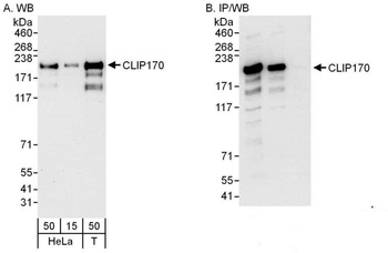 Rabbit CLIP170 Antibody