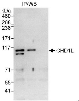 Rabbit CHD1L Antibody