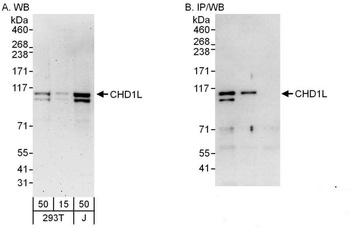 Rabbit CHD1L Antibody