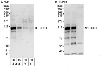 Rabbit BICD1 Antibody