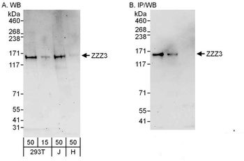 Rabbit ZZZ3 Antibody
