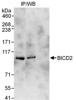 Rabbit BICD2 Antibody