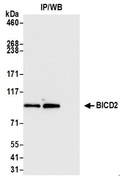 Rabbit BICD2 Antibody