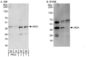 Rabbit AIDA Antibody