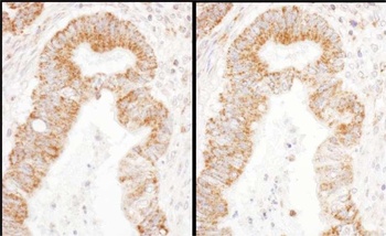 Rabbit TFAM Antibody