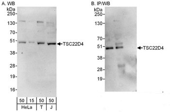 Rabbit TSC22D4 Antibody