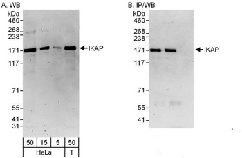 Rabbit IKAP Antibody