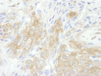 Rabbit 14-3-3 theta Antibody