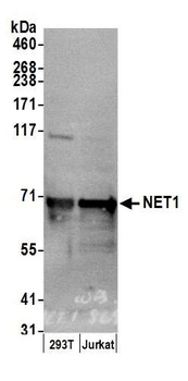 Rabbit NET1 Antibody