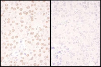 Rabbit NFIC Antibody