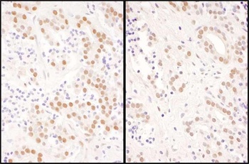 Rabbit NFIC Antibody