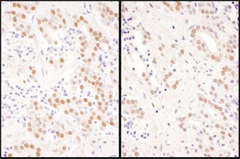 Rabbit NFIC Antibody