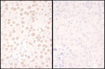 Rabbit NFIC Antibody