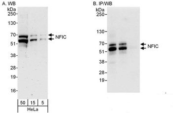 Rabbit NFIC Antibody