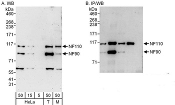 Rabbit NF90/NF110 Antibody