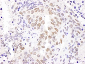 Rabbit HEXIM1 Antibody