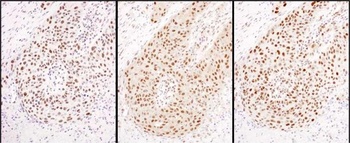 Rabbit HEXIM1 Antibody
