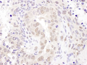 Rabbit HEXIM1 Antibody