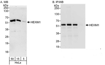 Rabbit HEXIM1 Antibody
