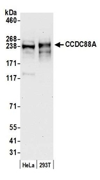 Rabbit anti-CCDC88A Antibody