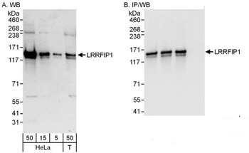Rabbit LRRFIP1 Antibody