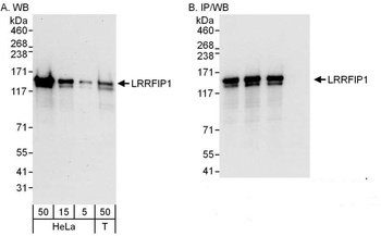 Rabbit LRRFIP1 Antibody