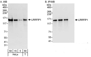 Rabbit LRRFIP1 Antibody